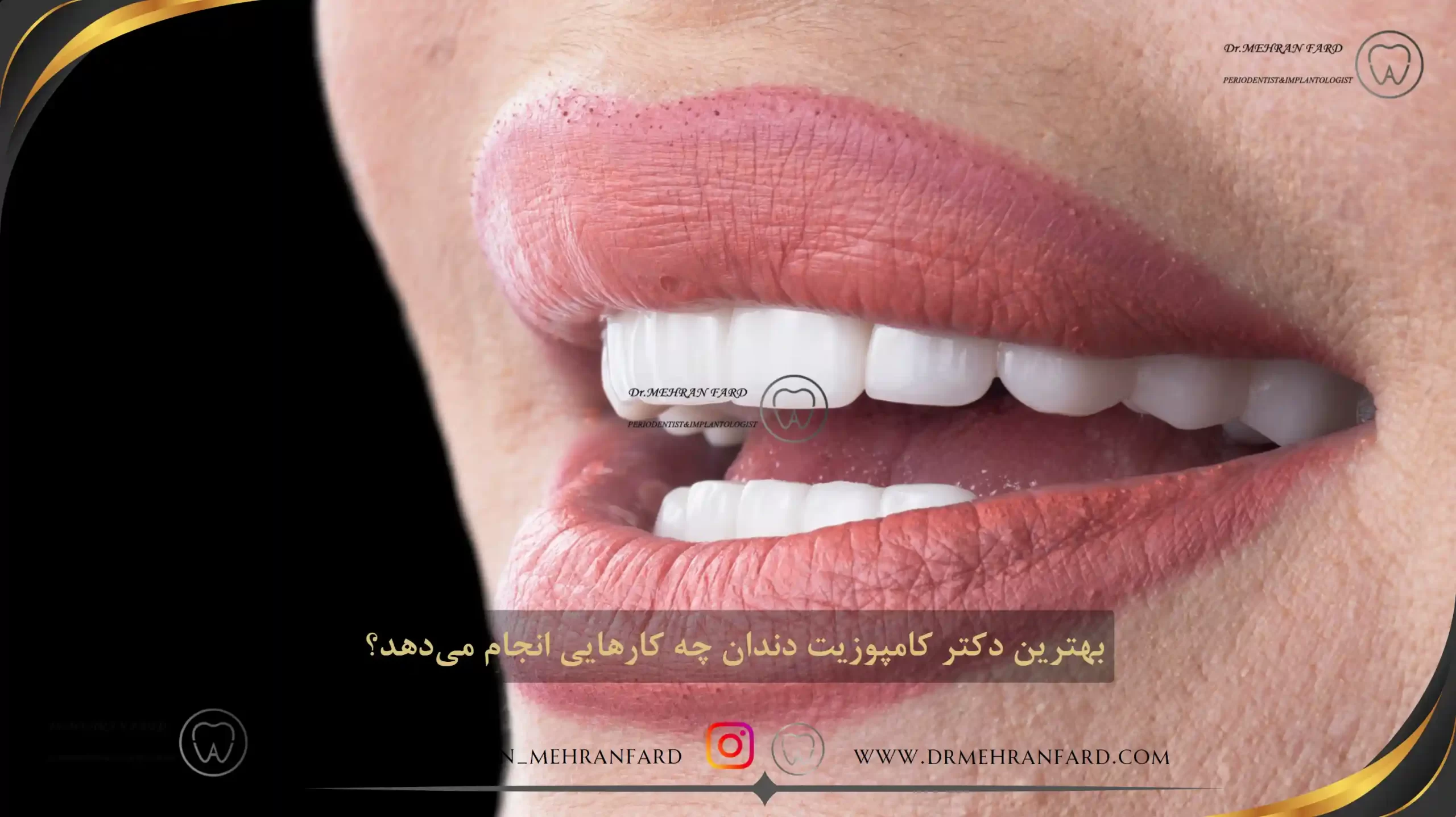 بهترین دکتر کامپوزیت دندان چه کارهایی انجام می‌دهد؟