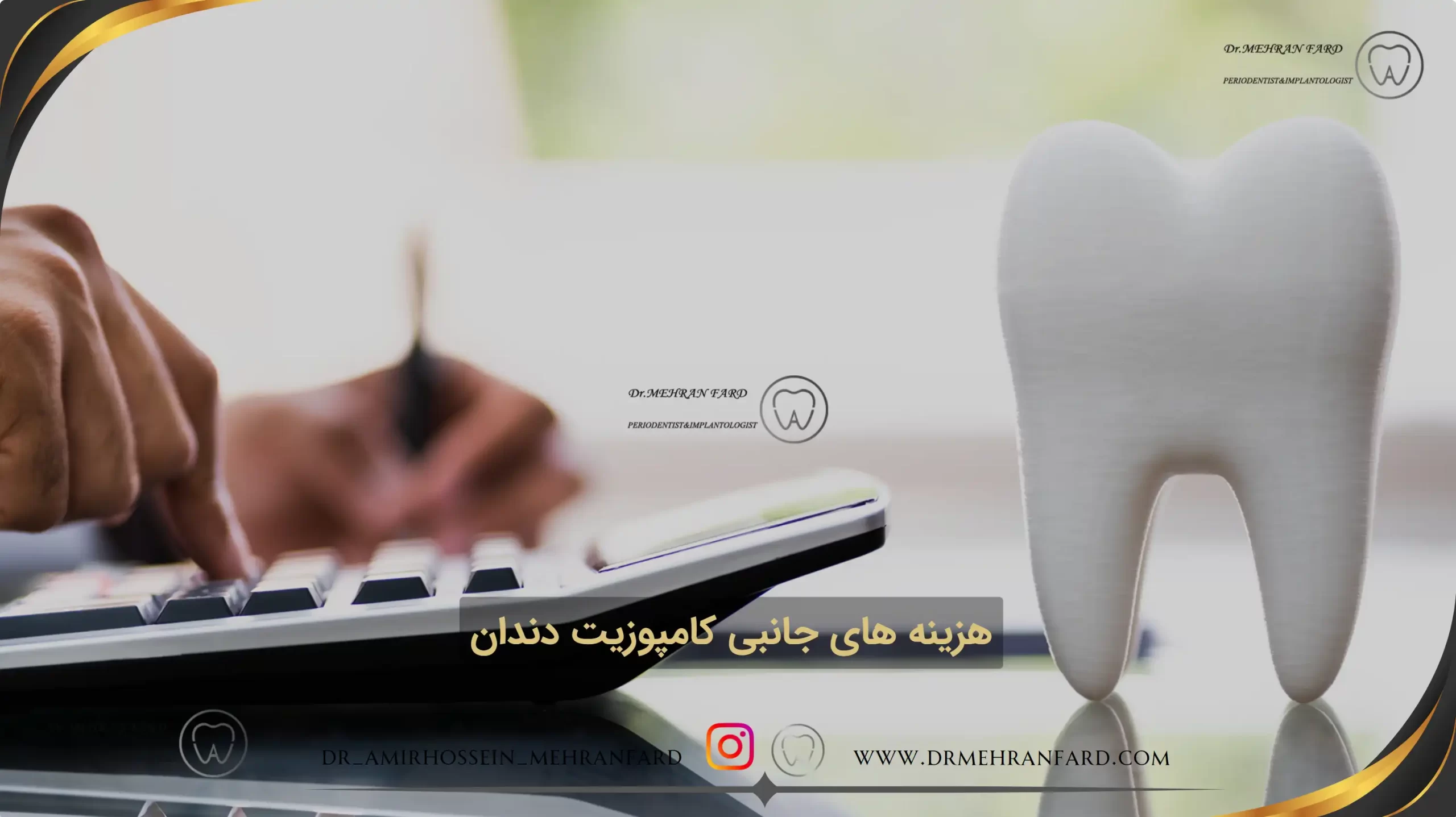 هزینه های جانبی کامپوزیت دندان