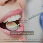 ✨17 تا از بهترین برند کامپوزیت دندان🦷[ ویژگی،مزایا،قیمت]