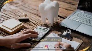 هزینه و قیمت کامپوزیت دندان سال ۱۴۰۳