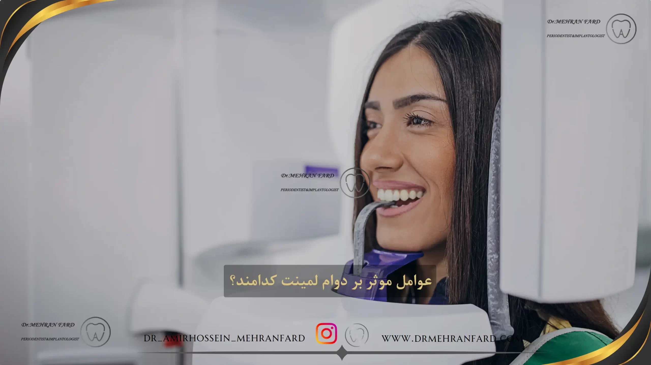 عوامل موثر بر دوام لمینت کدامند؟