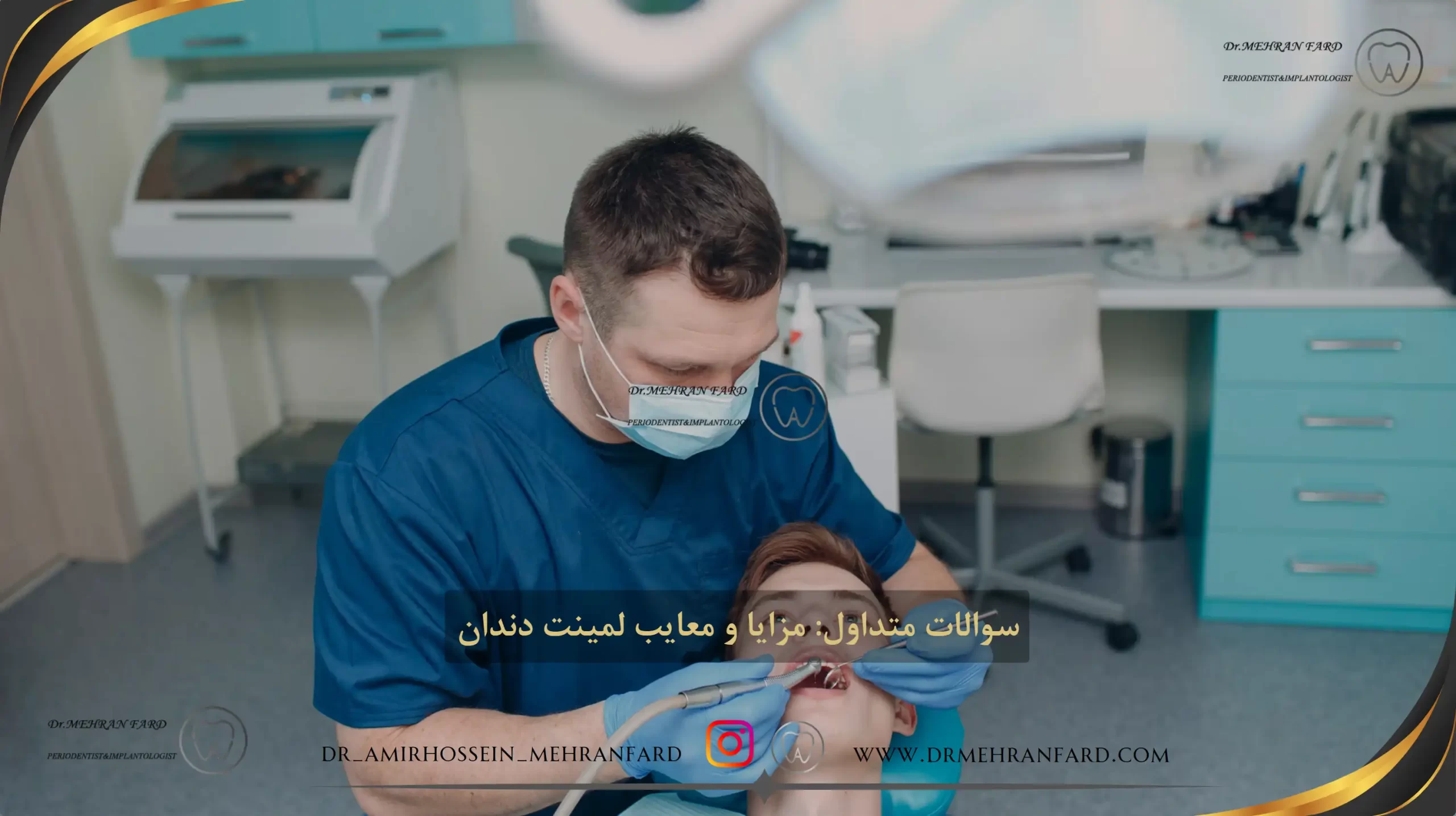 سوالات متداول مزایا و معایب لمینت دندان