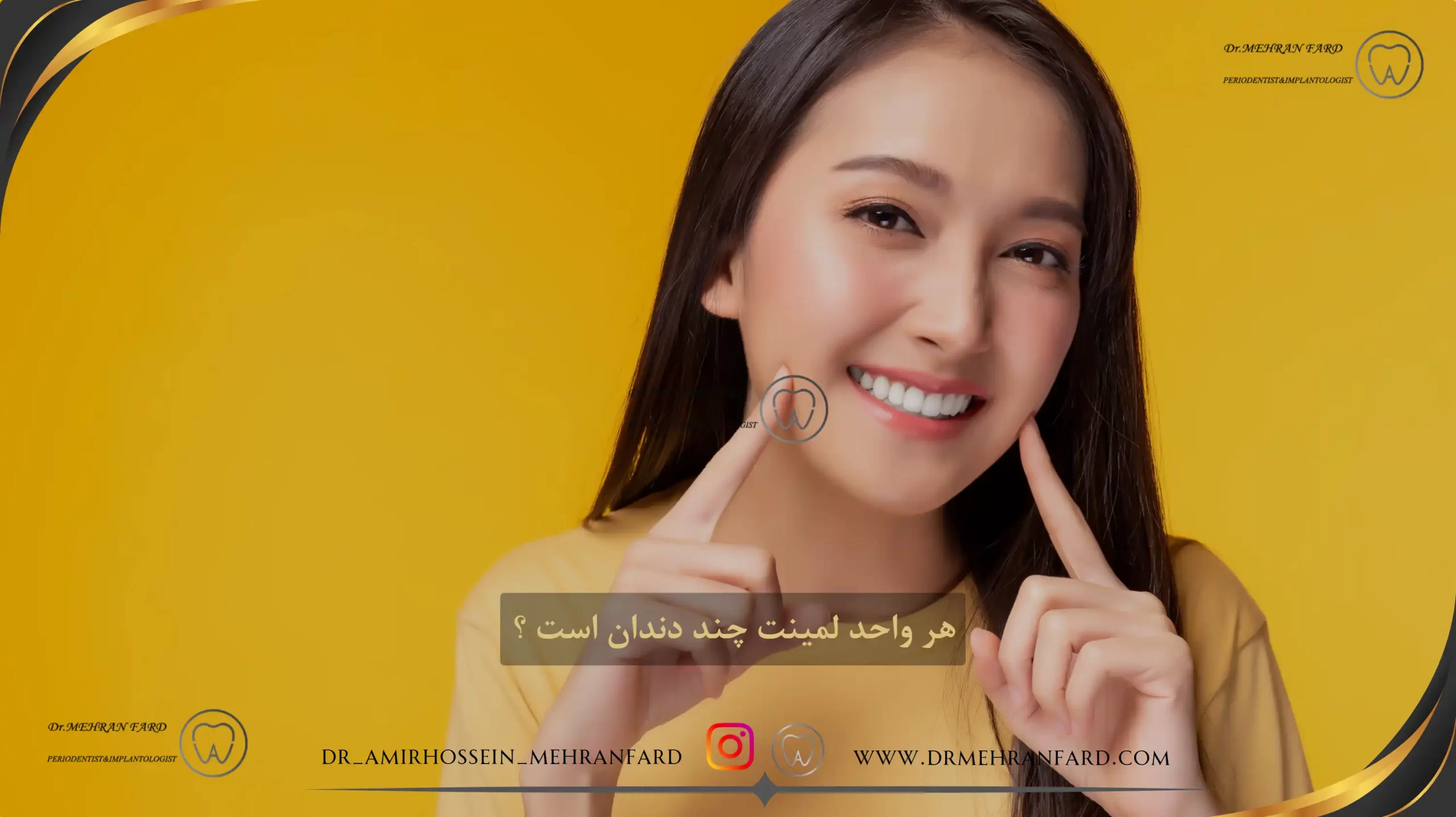 هر واحد لمینت چند دندان است؟