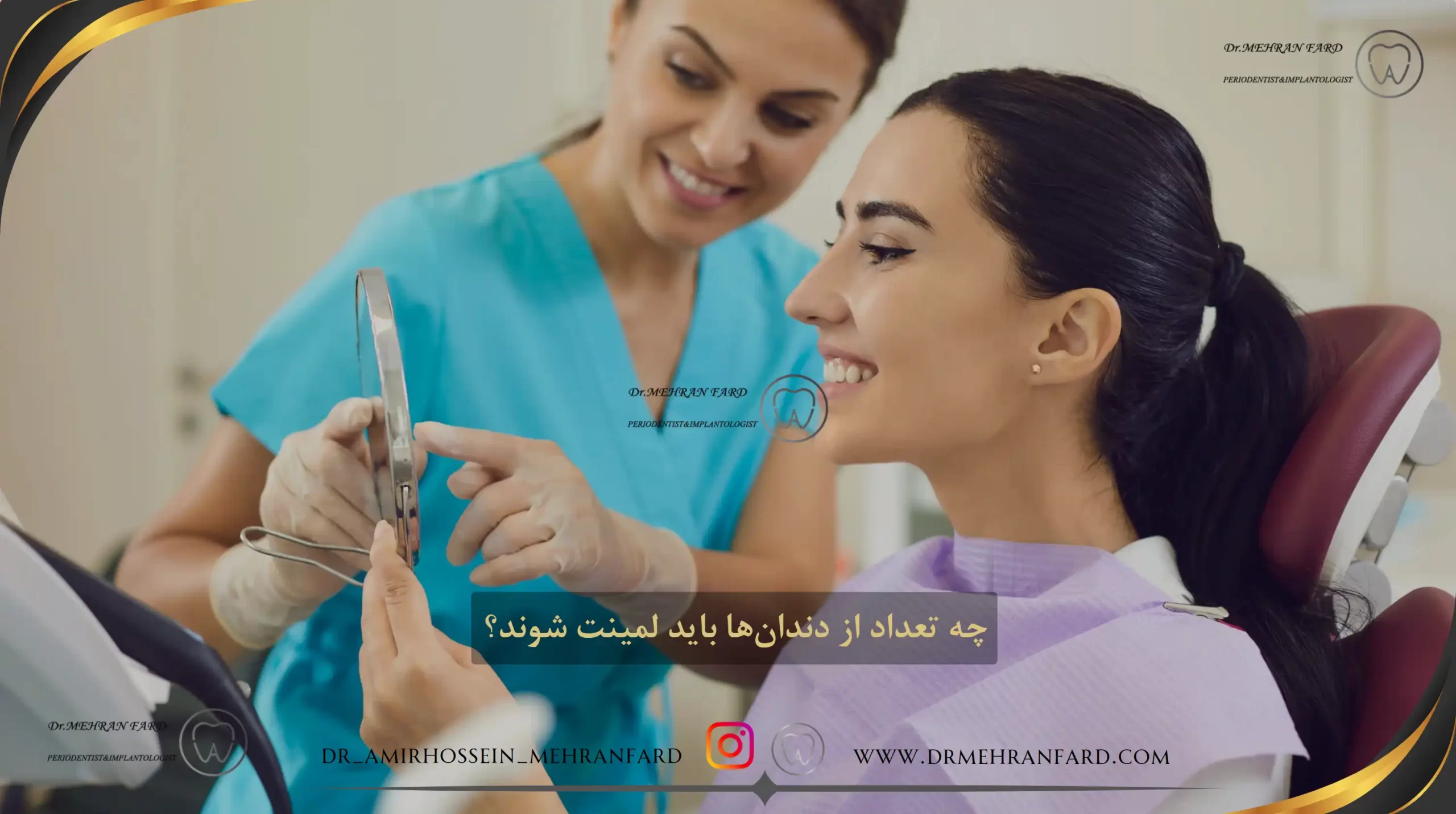 چه تعداد از دندان‌ها باید لمینت شوند؟