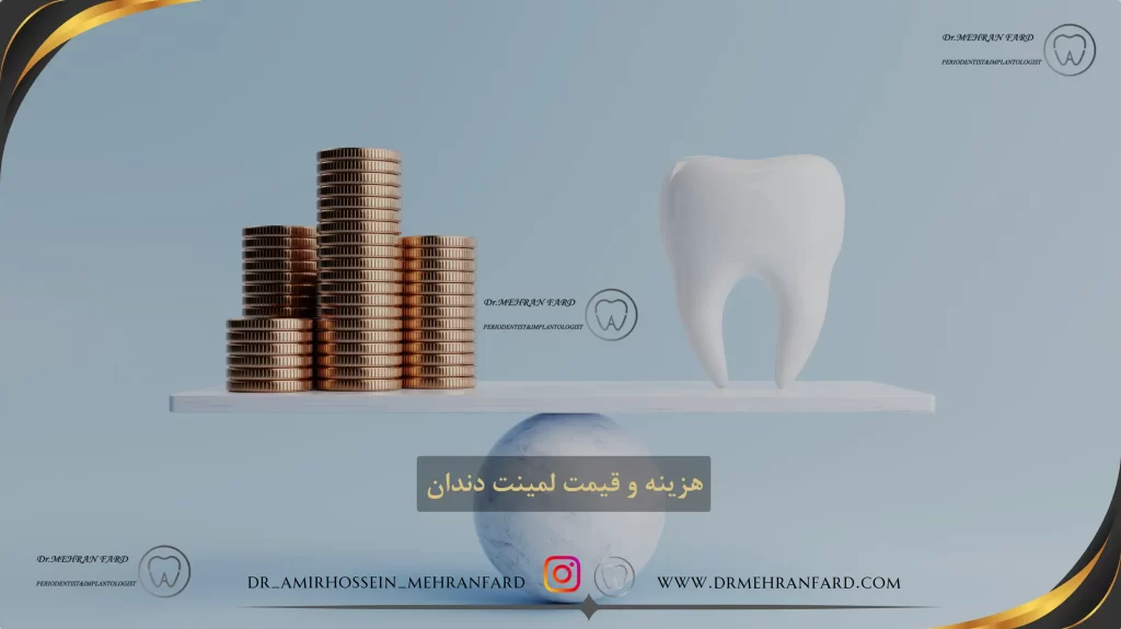 هزینه و قیمت لمینت دندان