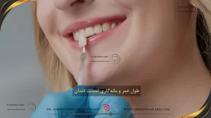 طول عمر و ماندگاری لمینت دندان