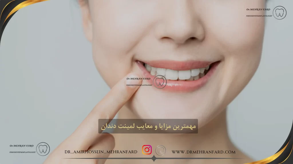 مهمترین مزایا و معایب لمینت دندان