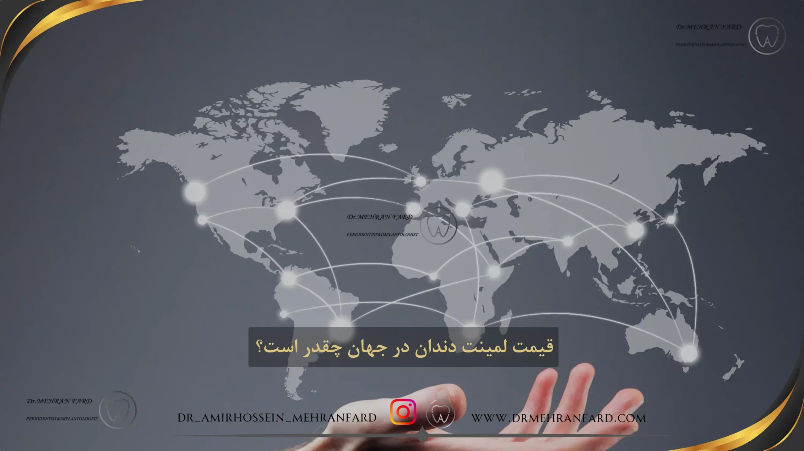 قیمت لمینت دندان در جهان چقدر است؟