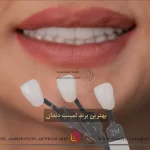 ✨7 تا از بهترین برند لمینت دندان🦷+[نکات مهم، راهنمای انتخاب]